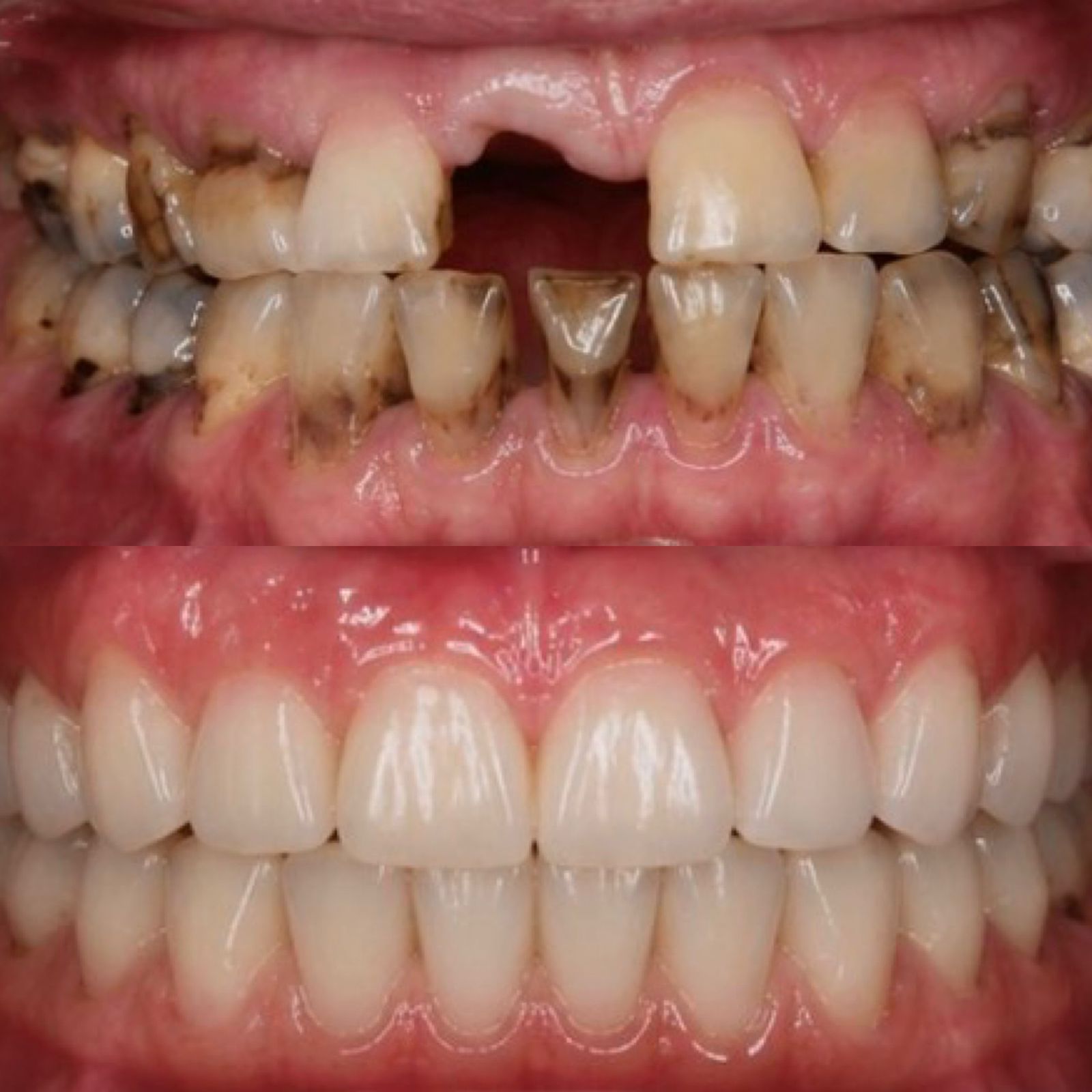 Cirugía Oral