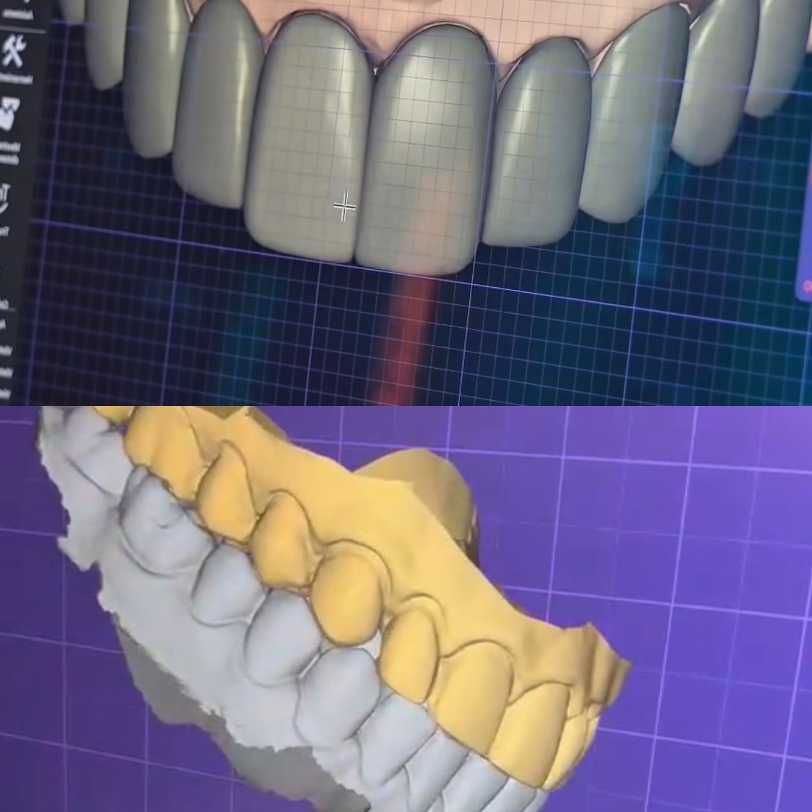 Rehabilitación Oral Digital